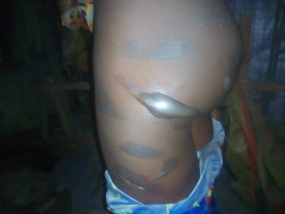 Kwara: Woman inflicts burns on housemaids for not flushing toilet